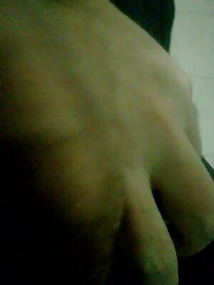 How about soe veins?