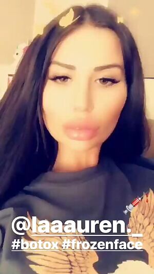 Big-lipped filler doll