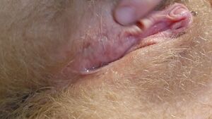 Tdick - FTM Big Clit Hairy