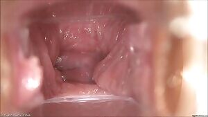 Insides of a vagina slowly closing up