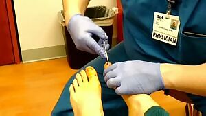 Toenail Removal