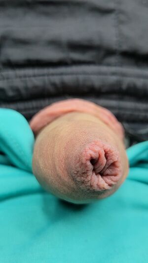 Foreskin Amateur Cock Cute Masturbating