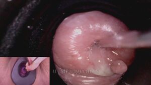 MedFet Gyno Medical Split Screen Porn