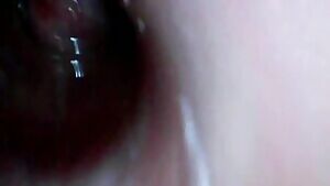 backing out of bladder