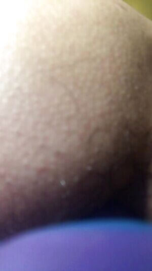 Echo close up