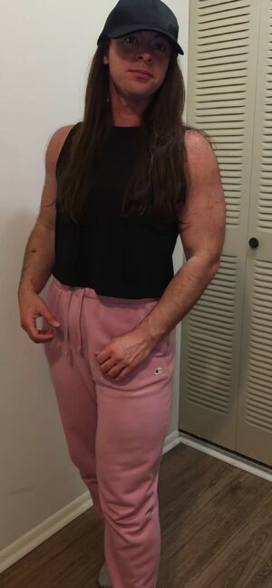 Hairy Girls