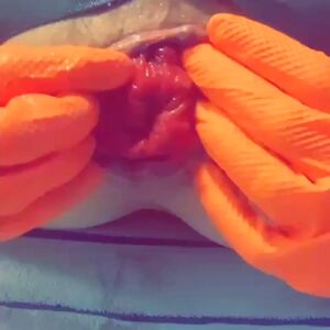 Stuffed Anal Fisting Ass Spread Extreme