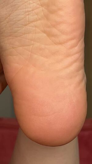 Feet Soles Toes