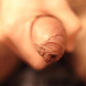Peeling