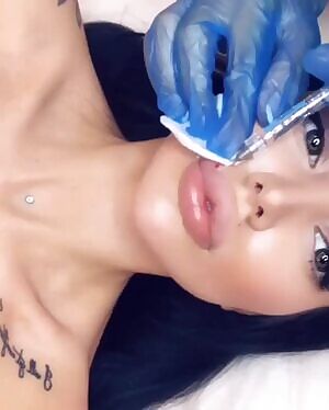 Injections