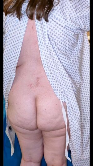 MedFet Ass Spread Asshole Chubby Medical Fetish