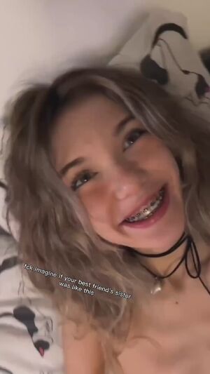Tik Tok 18 Years Old Braces
