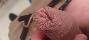 Uncut Cock Foreskin